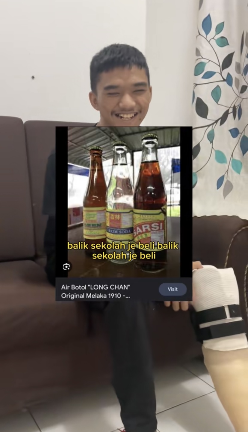 21yo m'sian man has his left leg amputated for drinking carbonated drink every day | weirdkaya