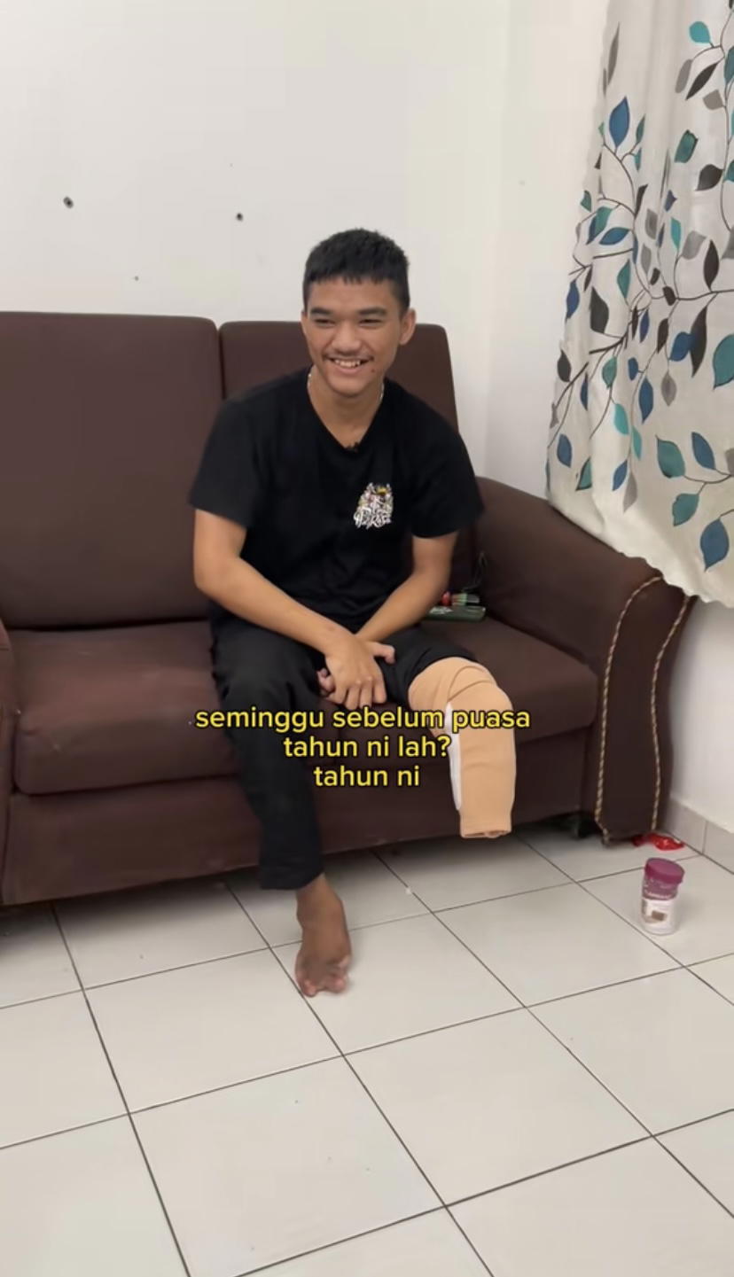 Mahathir, 21 years old man has his left leg amputated