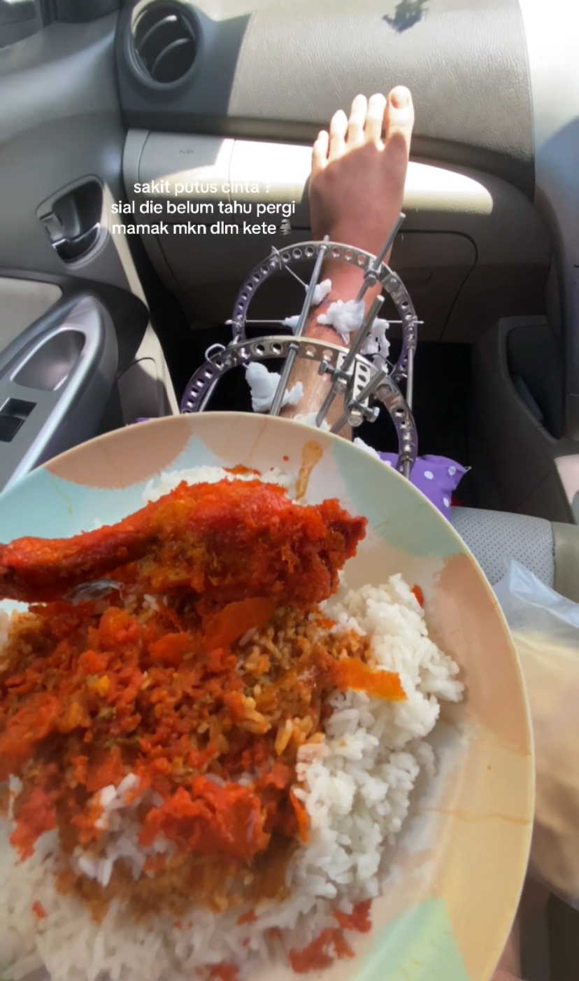 Man eat mamak food inside car post leg surgery