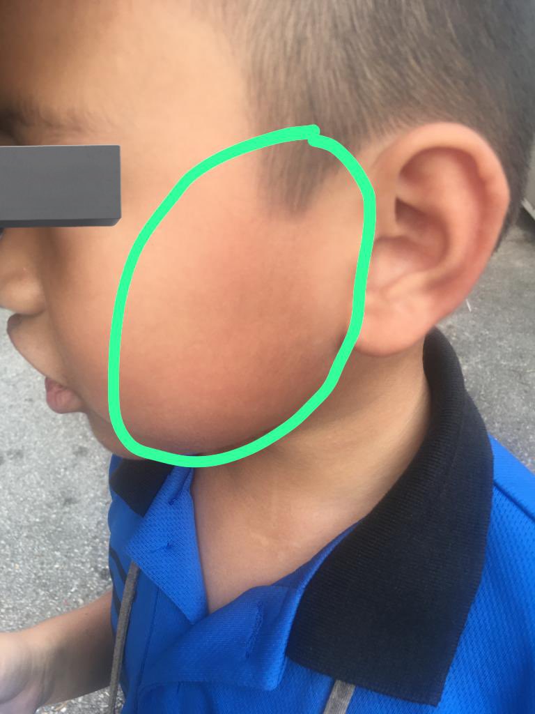 7yo m'sian student allegedly slapped by teacher for not being able to find letter inside schoolbag 