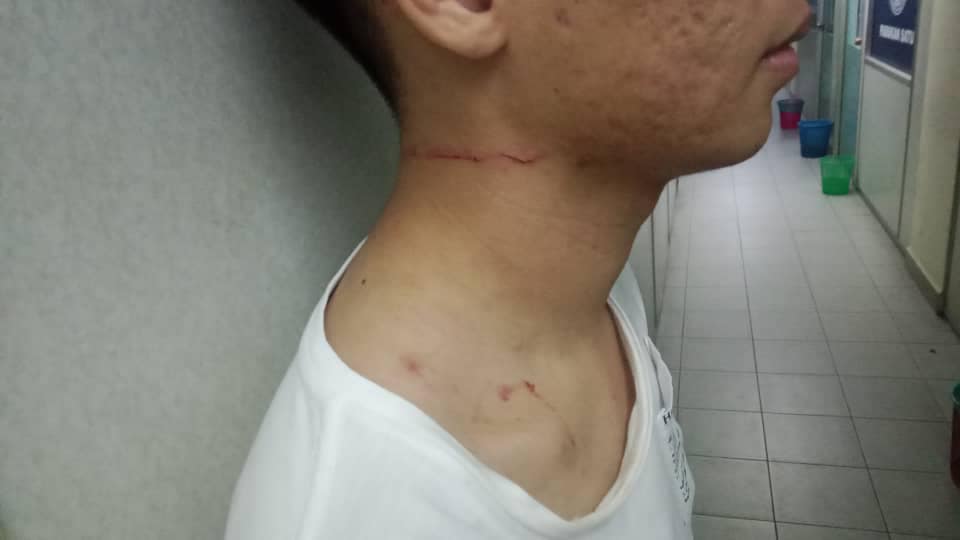 Injuries suffered by m'sian grab driver after the assault
