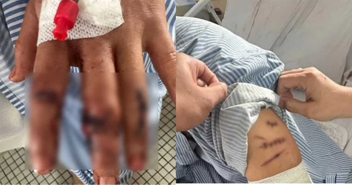 Injuries sustained by victim in glass shard attack