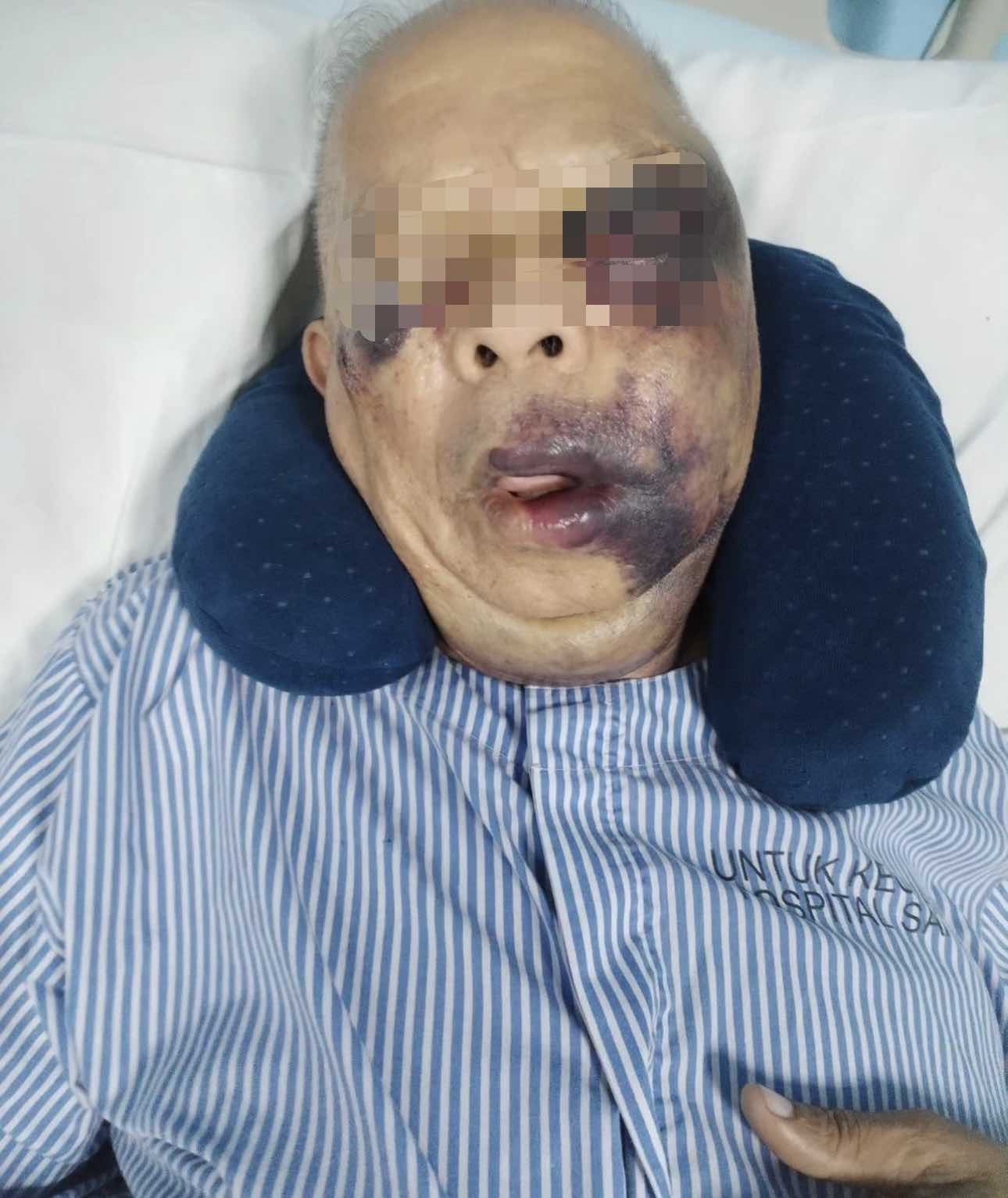Elderly man victim to road bully, admitted at hospital