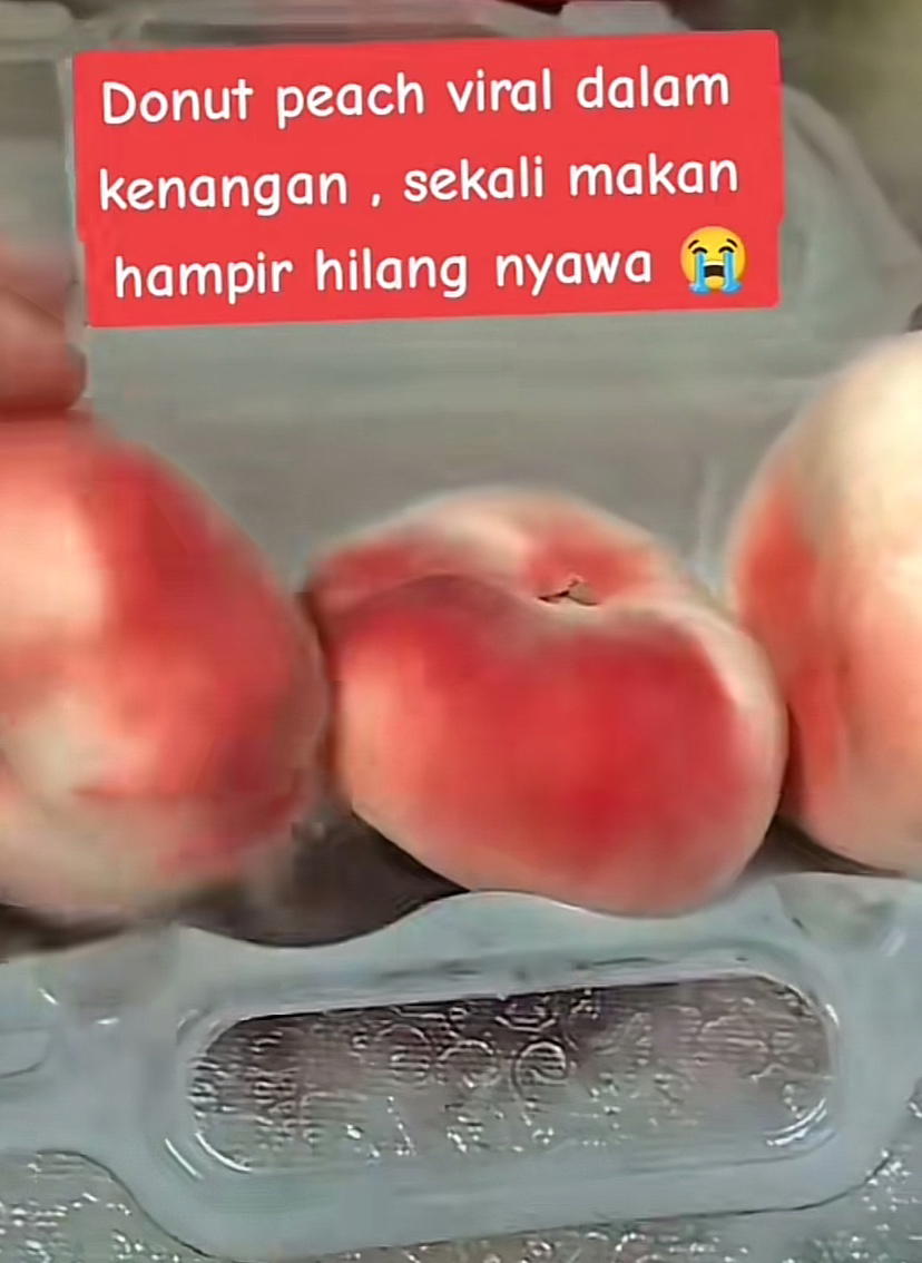 M'sian woman rushed to er due to severe allergic reaction after eating donut peach | weirdkaya