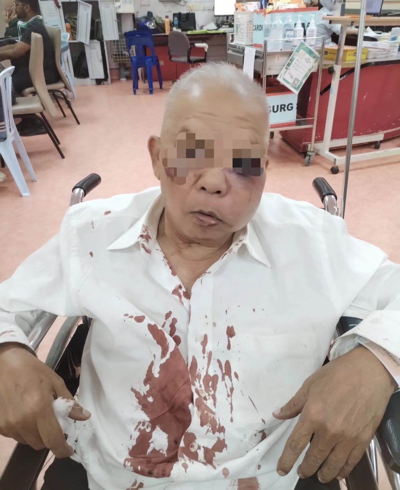 Elderly man with blood stains after being brutally attacked by road bully