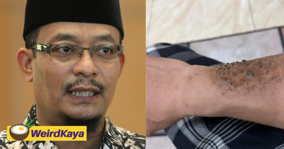 Ustaz kazim on the hunt for thai 'bomoh' believed to have casted a disease on him | weirdkaya