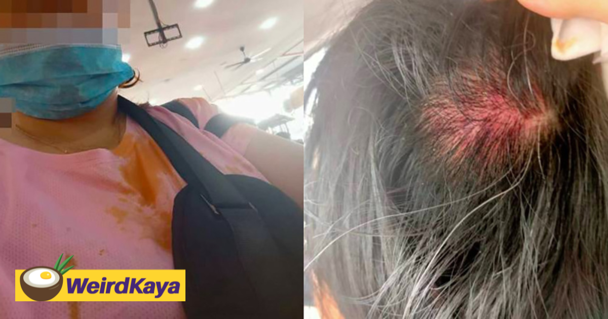 M'sian woman beaten by stall owner after she complained rm12 nasi lemak was too expensive | weirdkaya
