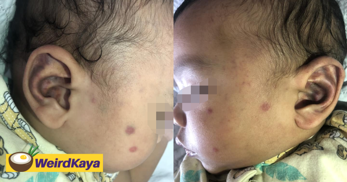 Nanny pinches m'sian baby's ears & cheeks, blames it on bad mood caused by her period | weirdkaya