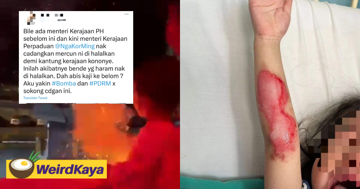M'sian Man Blames Govt After Kid Gets Injured While Holding Fireworks, Netizens Slam Him As 'Illogical'