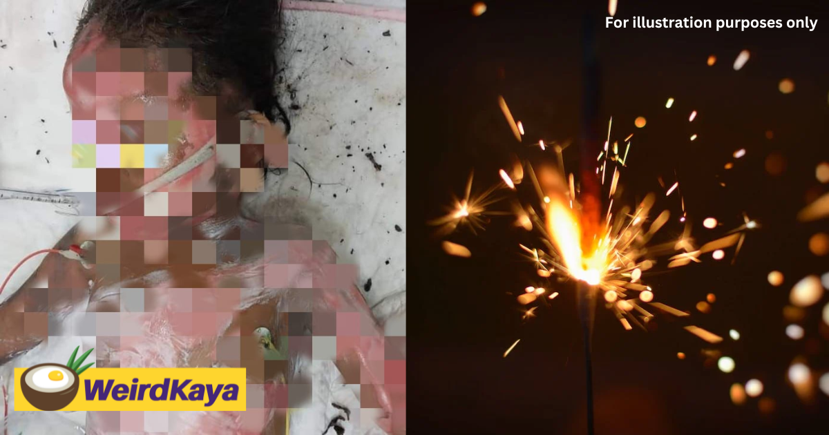 4yo m'sian girl suffers burns to 46% of her body while playing firecrackers with her siblings | weirdkaya