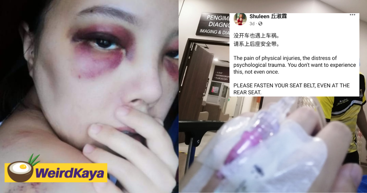 M'sian dj left bruised after she hit car dashboard in accident as she did not wear a seatbelt in rear seat | weirdkaya