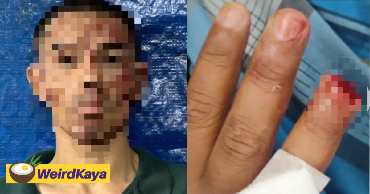 M'sian police officer gets finger bitten off by man who threatened to splash acid | weirdkaya