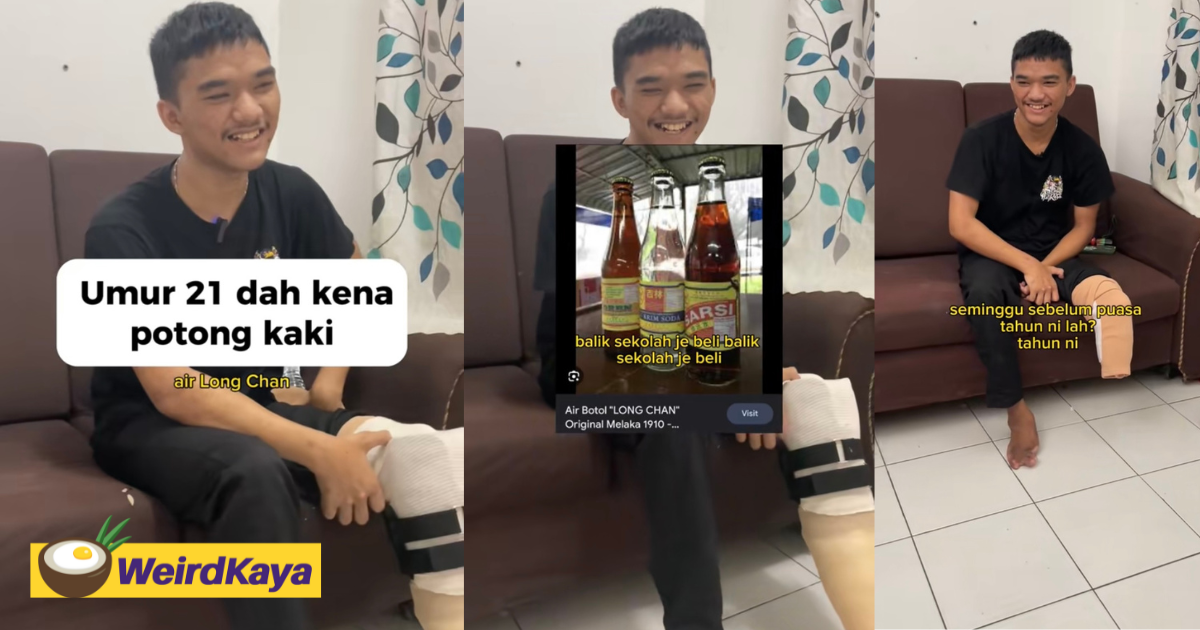 21yo m'sian man has his left leg amputated for drinking carbonated drink every day | weirdkaya