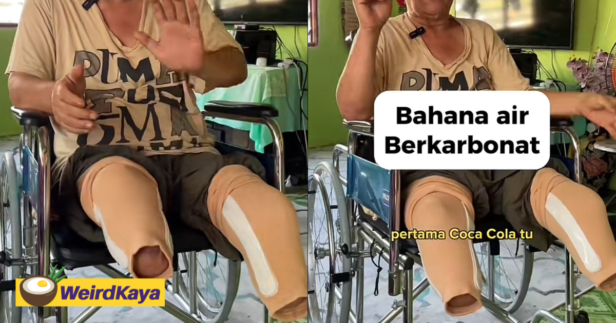M'sian man loses legs to diabetes by drinking soft drinks every day, says it's not worth it | weirdkaya