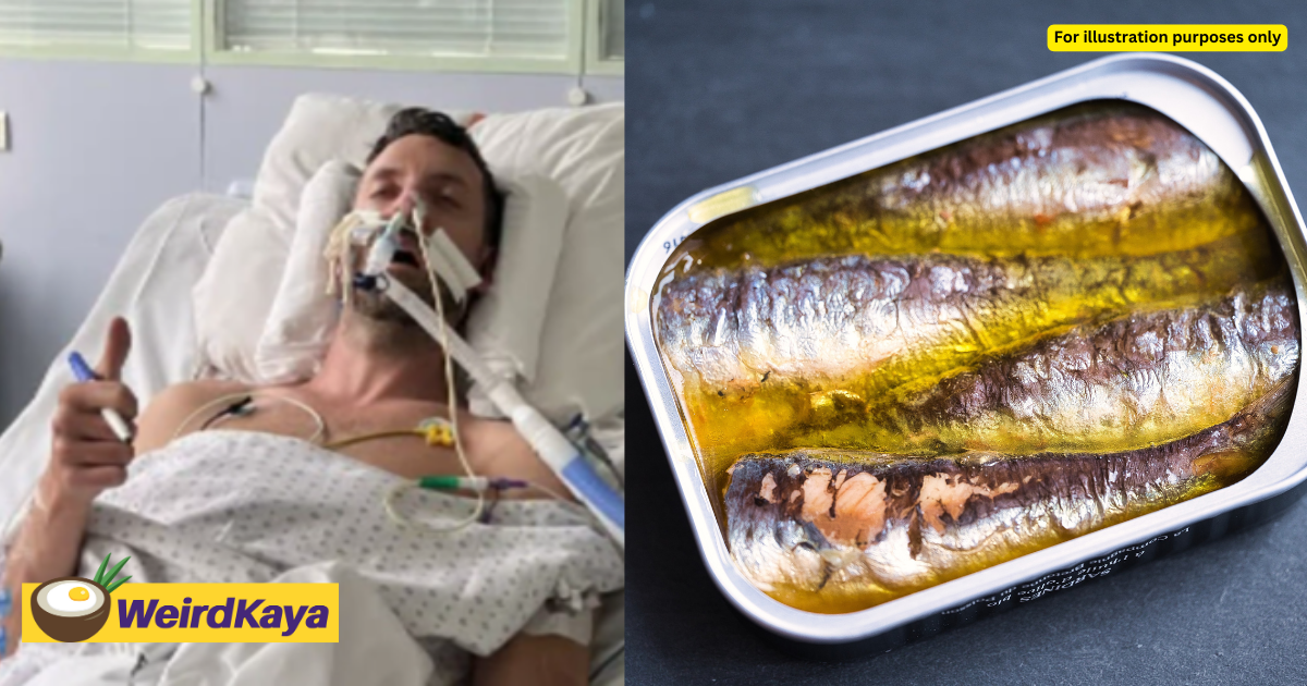 Man loses ability to see and speak after eating tainted sardines in france | weirdkaya