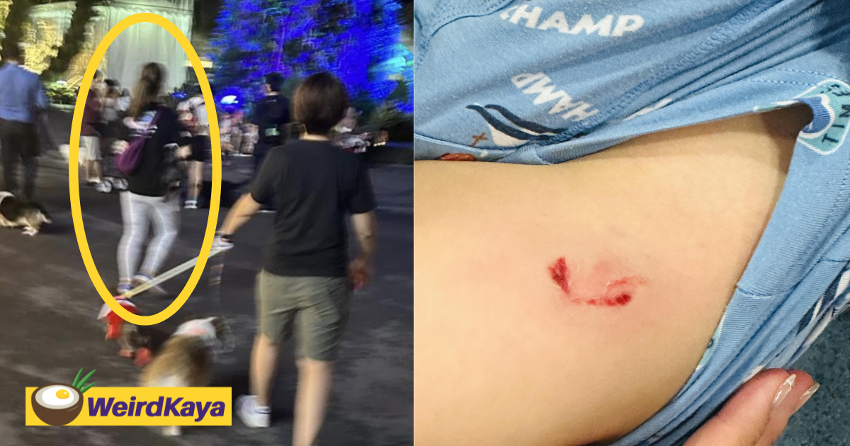 Dog bites 4yo boy at christmas event in s'pore, owner says she's not liable for his injuries | weirdkaya