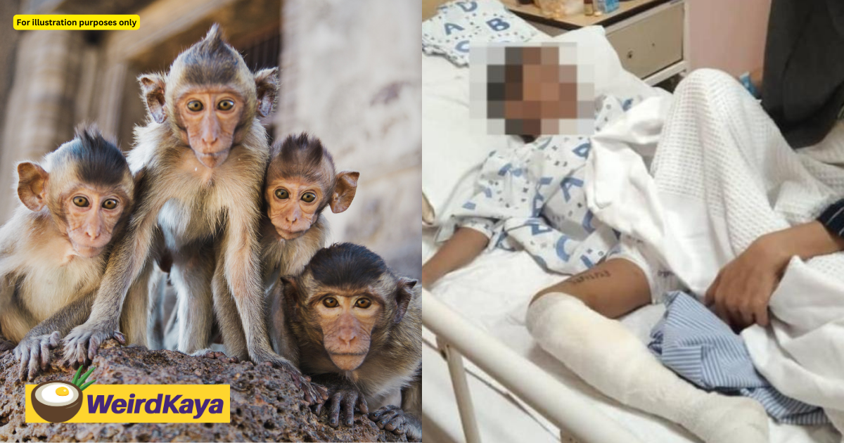 5yo m'sian boy attacked by over 30 monkeys, receives 30 stitches | weirdkaya