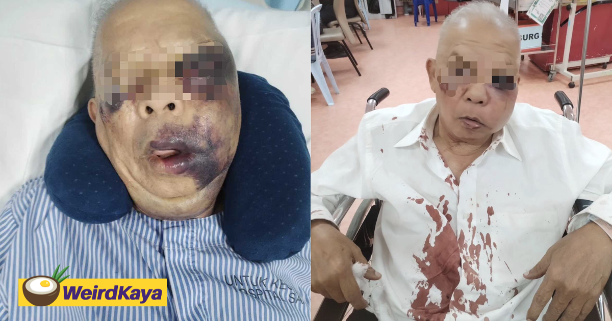 M'sian pleads for public's help in finding road bully who left her father severely injured | weirdkaya