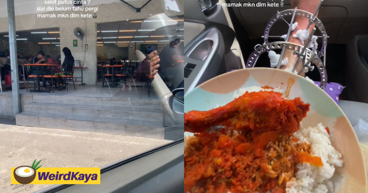 'more painful than a breakup' - m'sian man eats mamak meal inside car with foot in a metal cast | weirdkaya