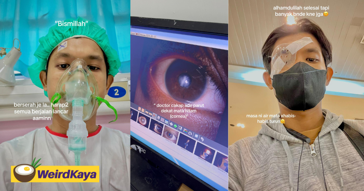 M'sian man scars cornea after he rubbed his eyes too frequently | weirdkaya