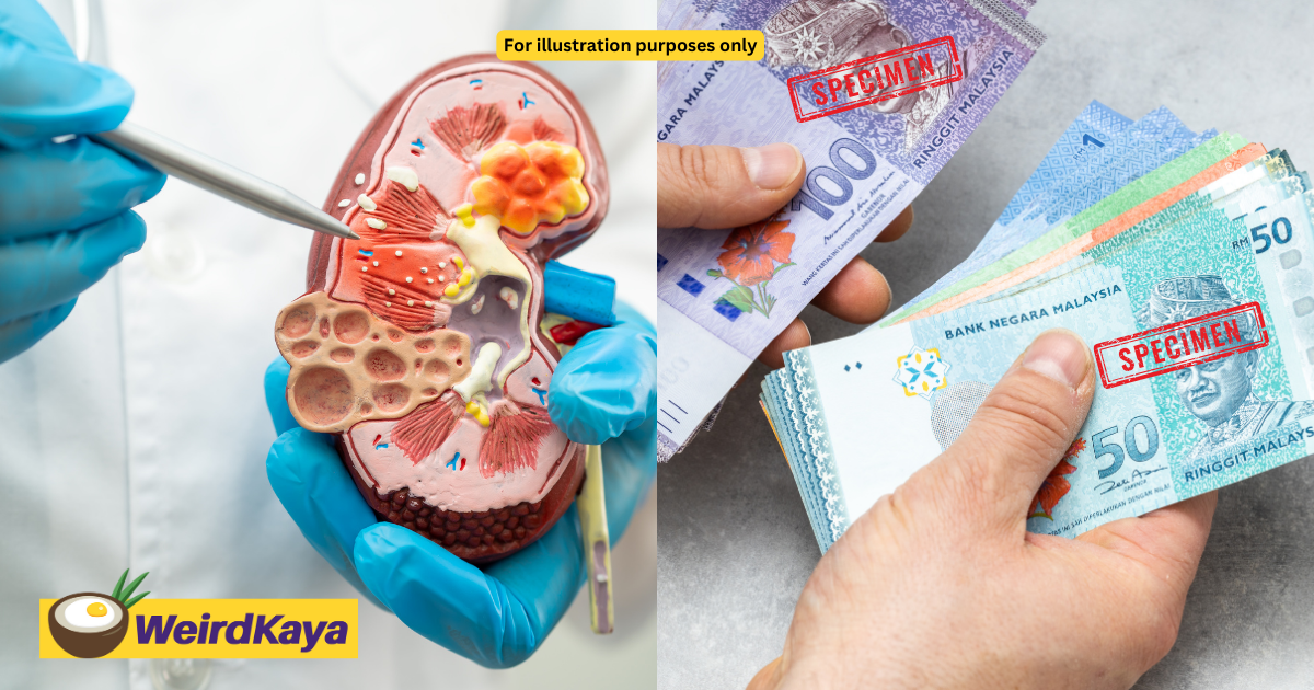 31yo m'sian man sells kidney for rm100k to clear father's debt | weirdkaya