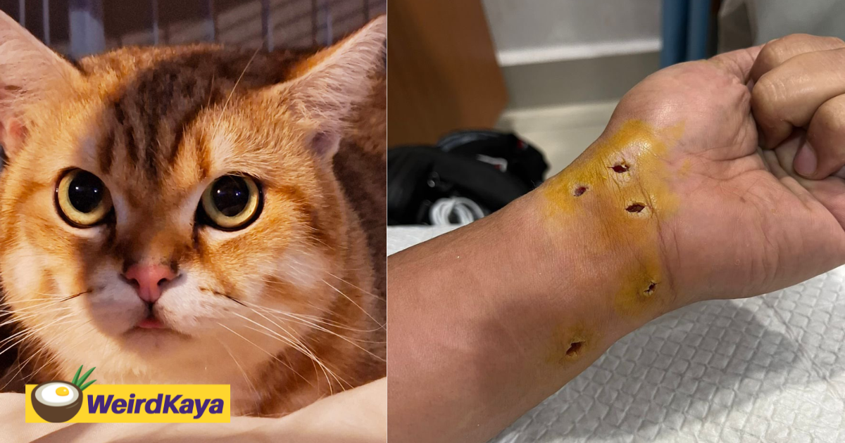 M'sian man left with rm17k hospital bill after getting bitten by cat | weirdkaya