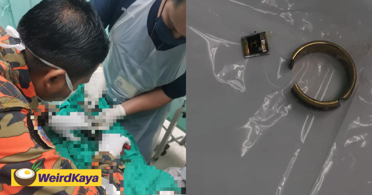 M'sian man calls firefighters for help after metal ring gets stuck on his genitals | weirdkaya