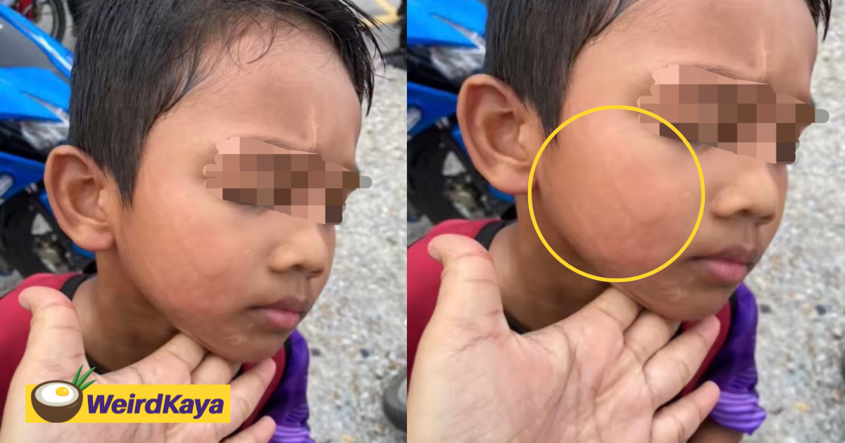 8yo M'sian Boy Allegedly Slapped By Teacher For Getting Into The Wrong Classroom