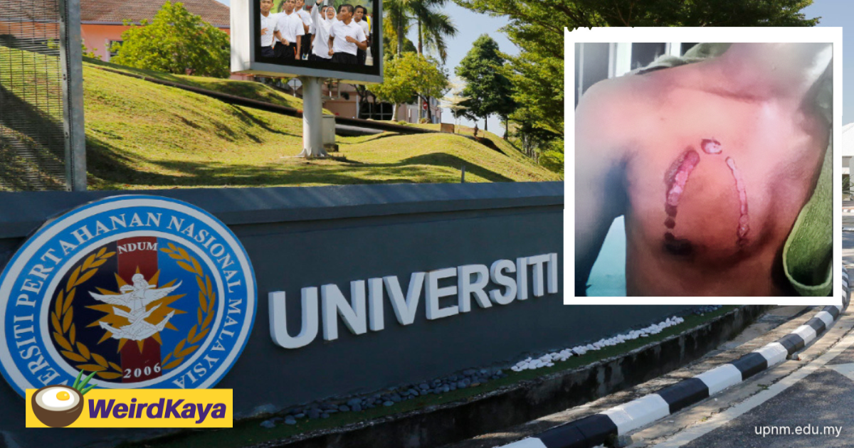 Another upnm cadet allegedly burnt with steam iron, investigations underway | weirdkaya