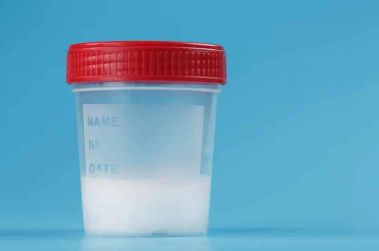 Male bodily fluid in a bottle