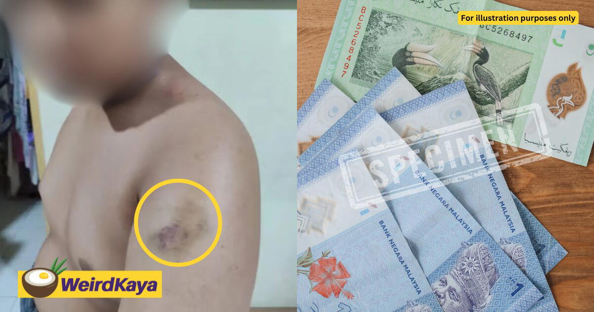 M’sian Boy Claims ‘Gangster’ Students Beat & Extorted Him For Months Over Pocket Money