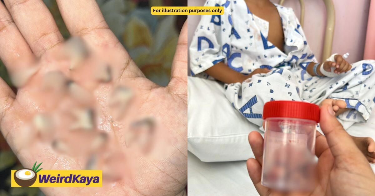 M’sian Boy Has 12 Teeth Removed Due To Severe Cavities Caused By Him Not Brushing Them Before Sleeping | WeirdKaya