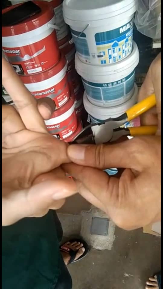 M'sian man calls bomba to remove ring which got stuck around his finger for 24 hours | weirdkaya