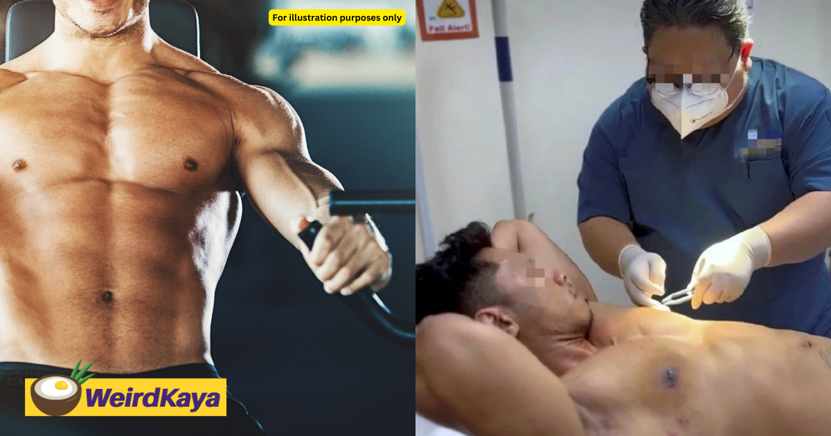 M'sian man who used steroids for muscle gain, now undergoes surgery for chest resembling breasts | weirdkaya