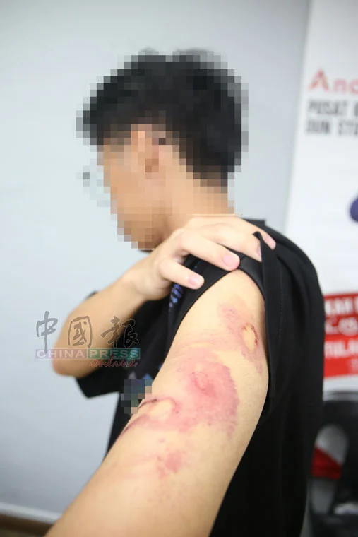 M'sian teen shows his bruises