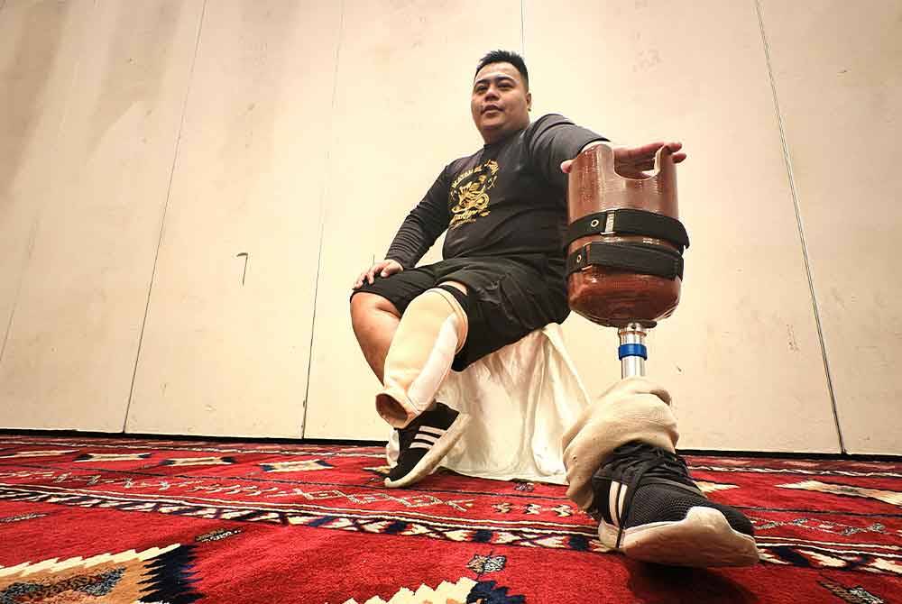 Muhammad azizi and his prosthetic leg