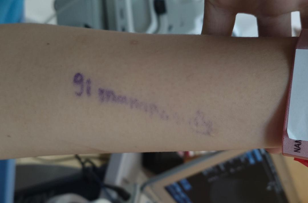 note on the wrist