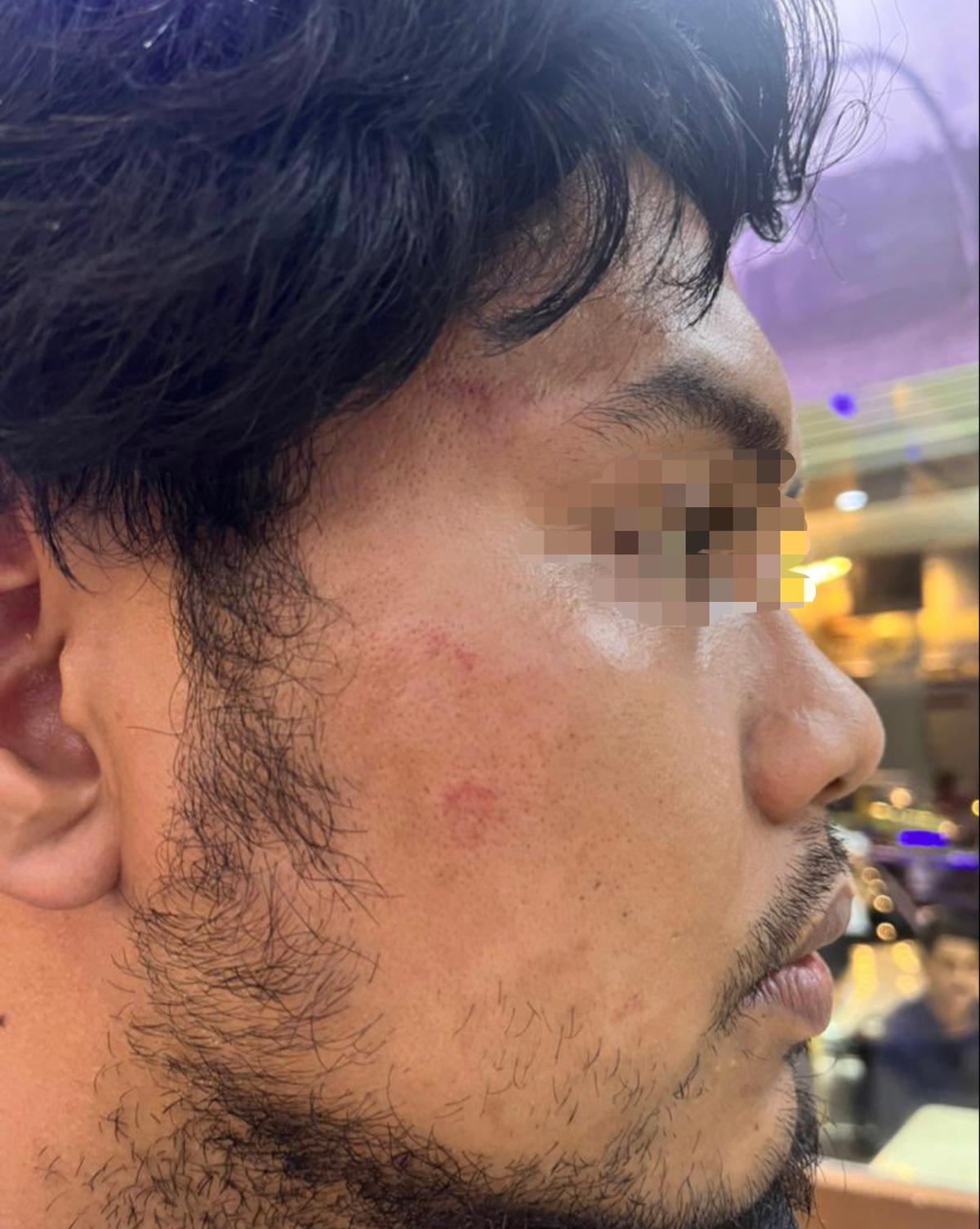 Man gets beat up by mamak workers after voicing displeasure over pricing and poor service | weirdkaya