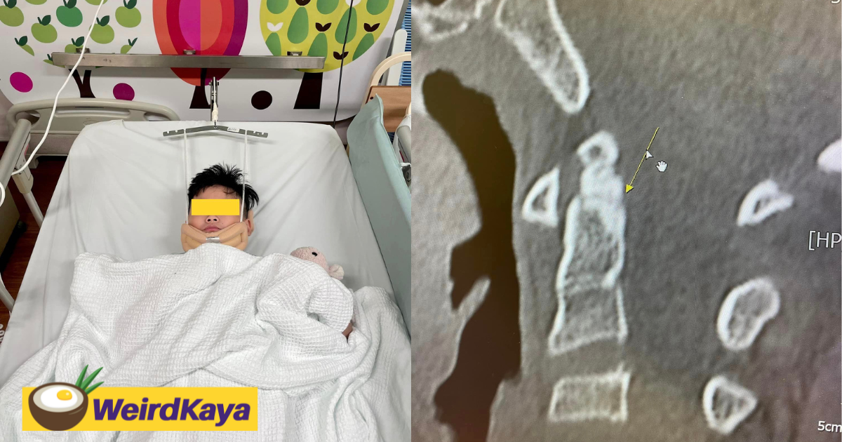 Penang woman claims son's bones were broken by classmate on purpose, alleges school refused to take action  | weirdkaya