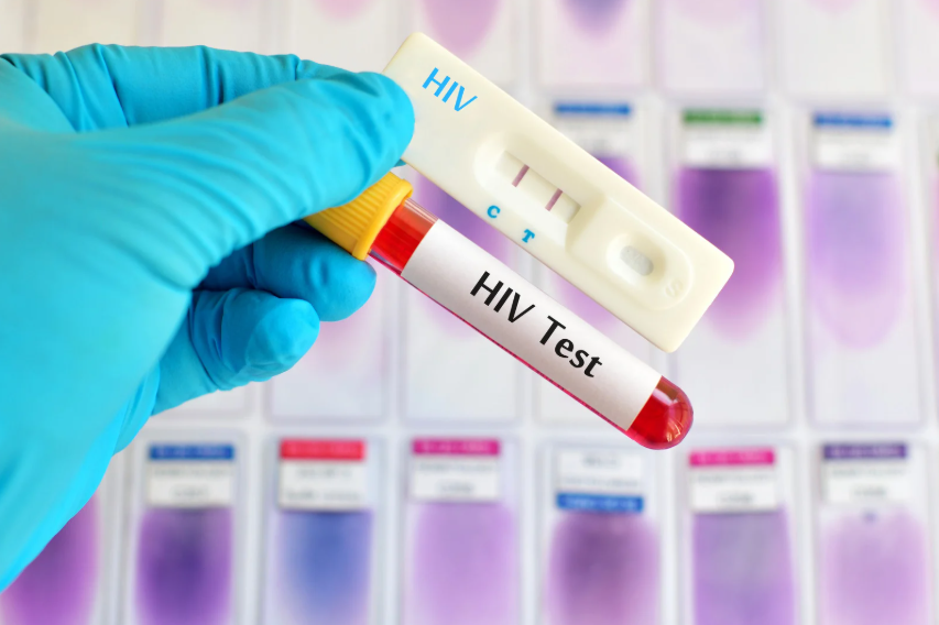 Positive HIV test