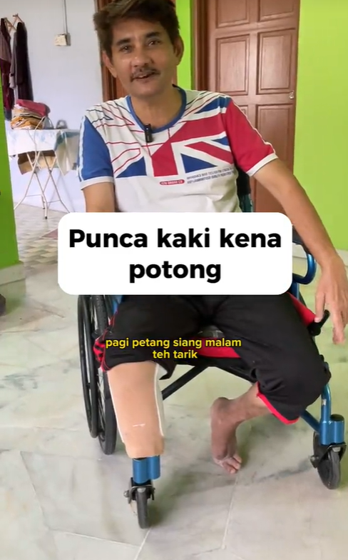 M'sian man has leg cut off after drinking teh tarik 3 times daily for years, now regrets not taking care of his health