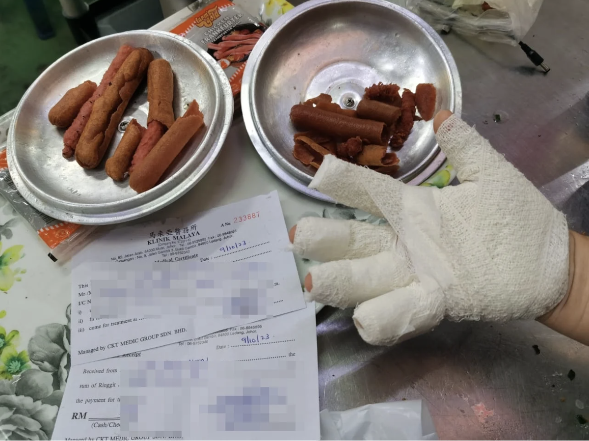 M’sian woman suffers burns after sausage ‘explodes’ inside frying pan | weirdkaya