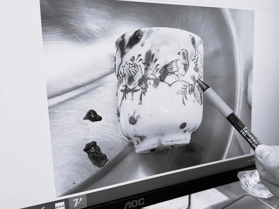 The ceramic cup in the patient's butt