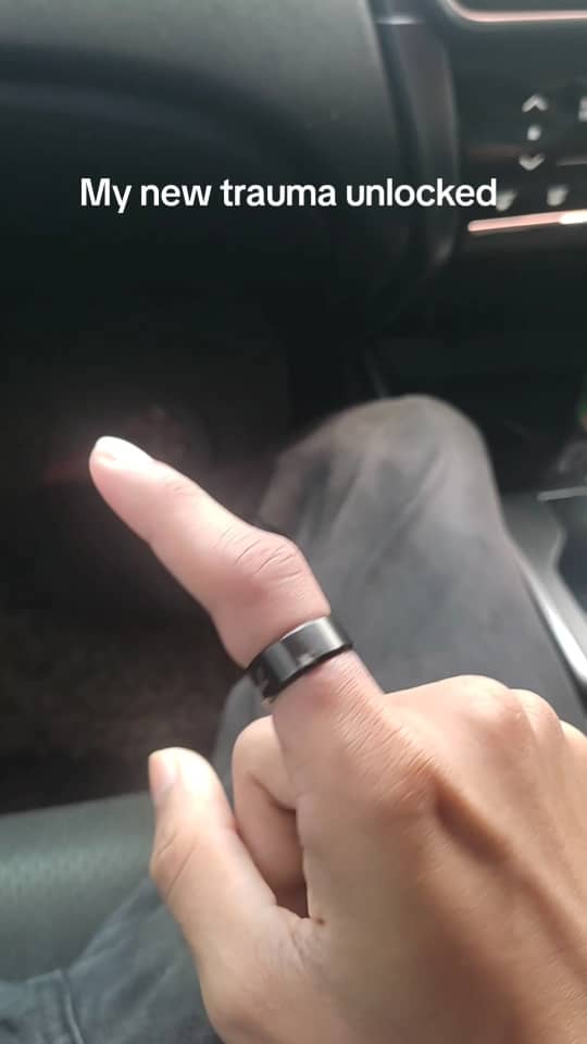 M'sian man calls bomba to remove ring which got stuck around his finger for 24 hours | weirdkaya