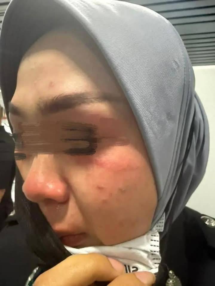 The staff who was attacked