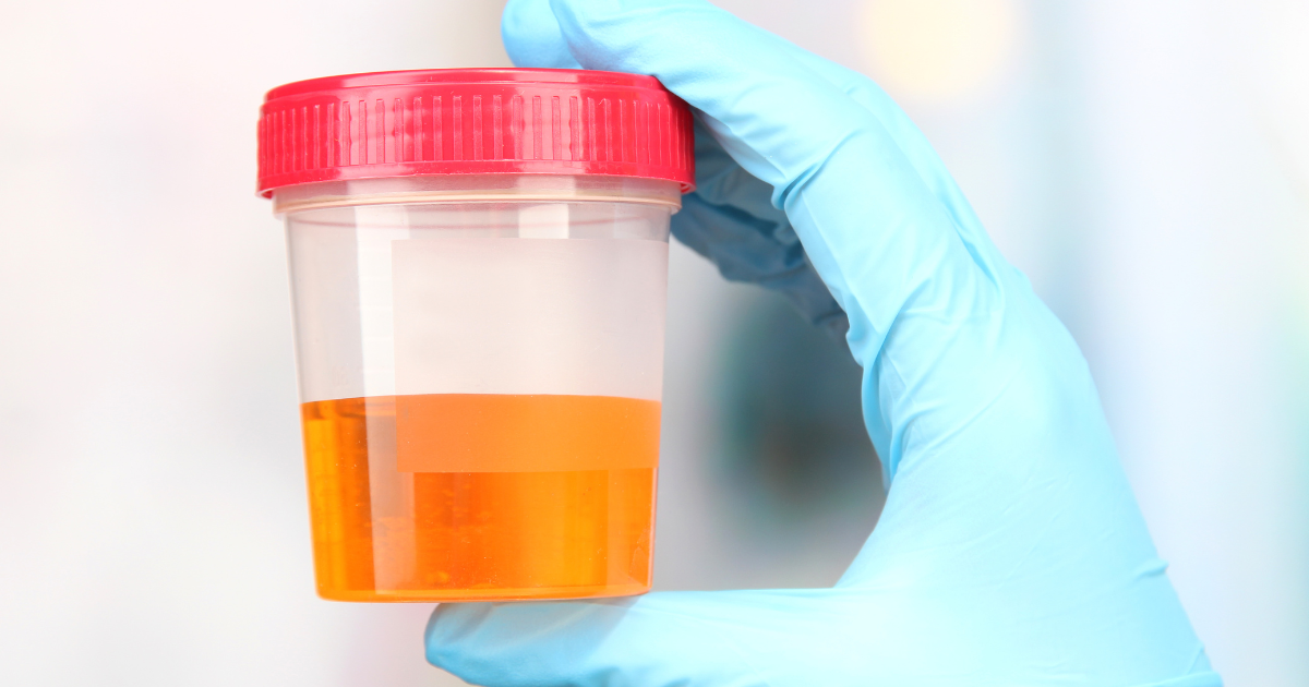 urine in test tube