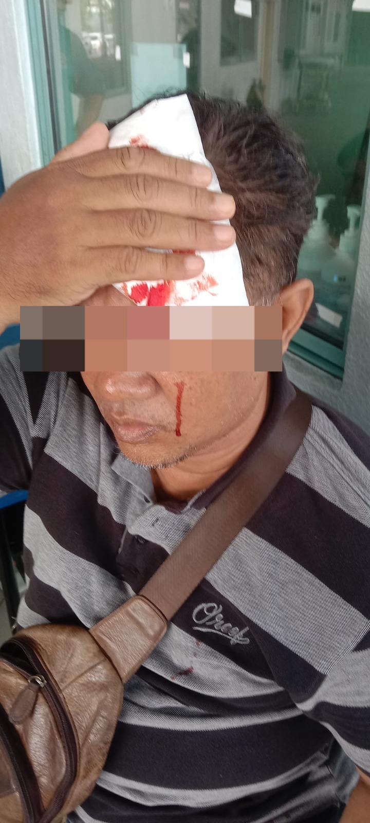 Msian man injured his head after a pole falls on him