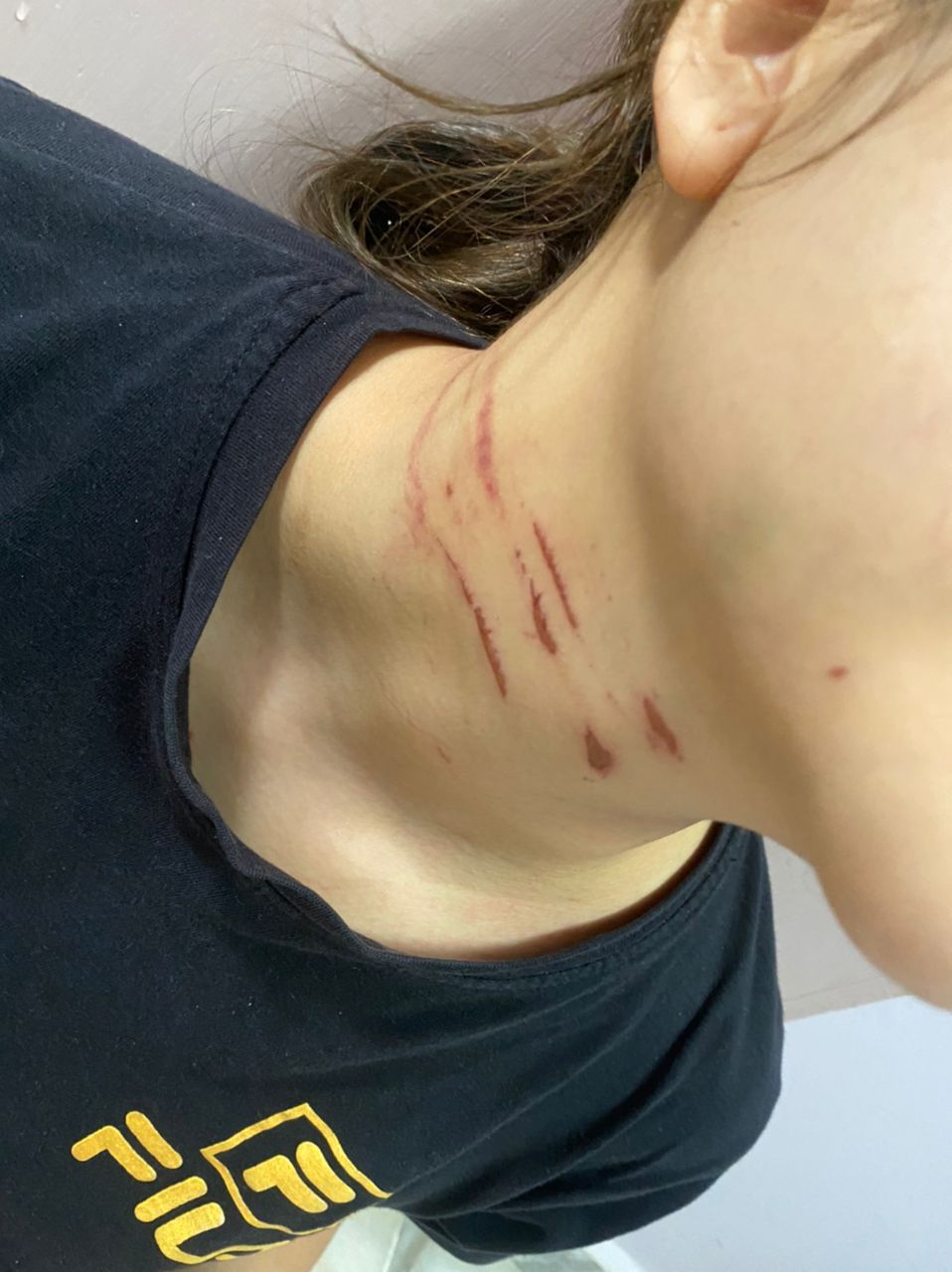woman grabbed on the neck