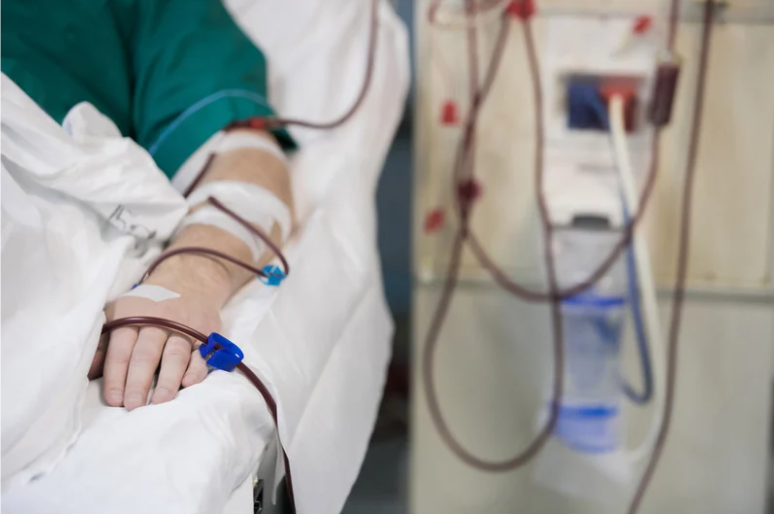 Woman undergoing dialysis treatment