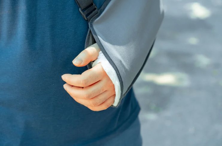 Woman's arm bandaged up